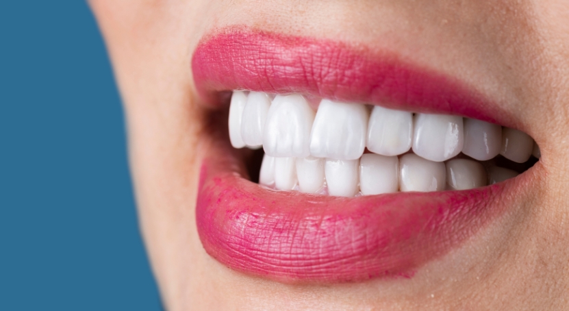 teeth-whitening-brush-n-floss-dental-victoria-australia